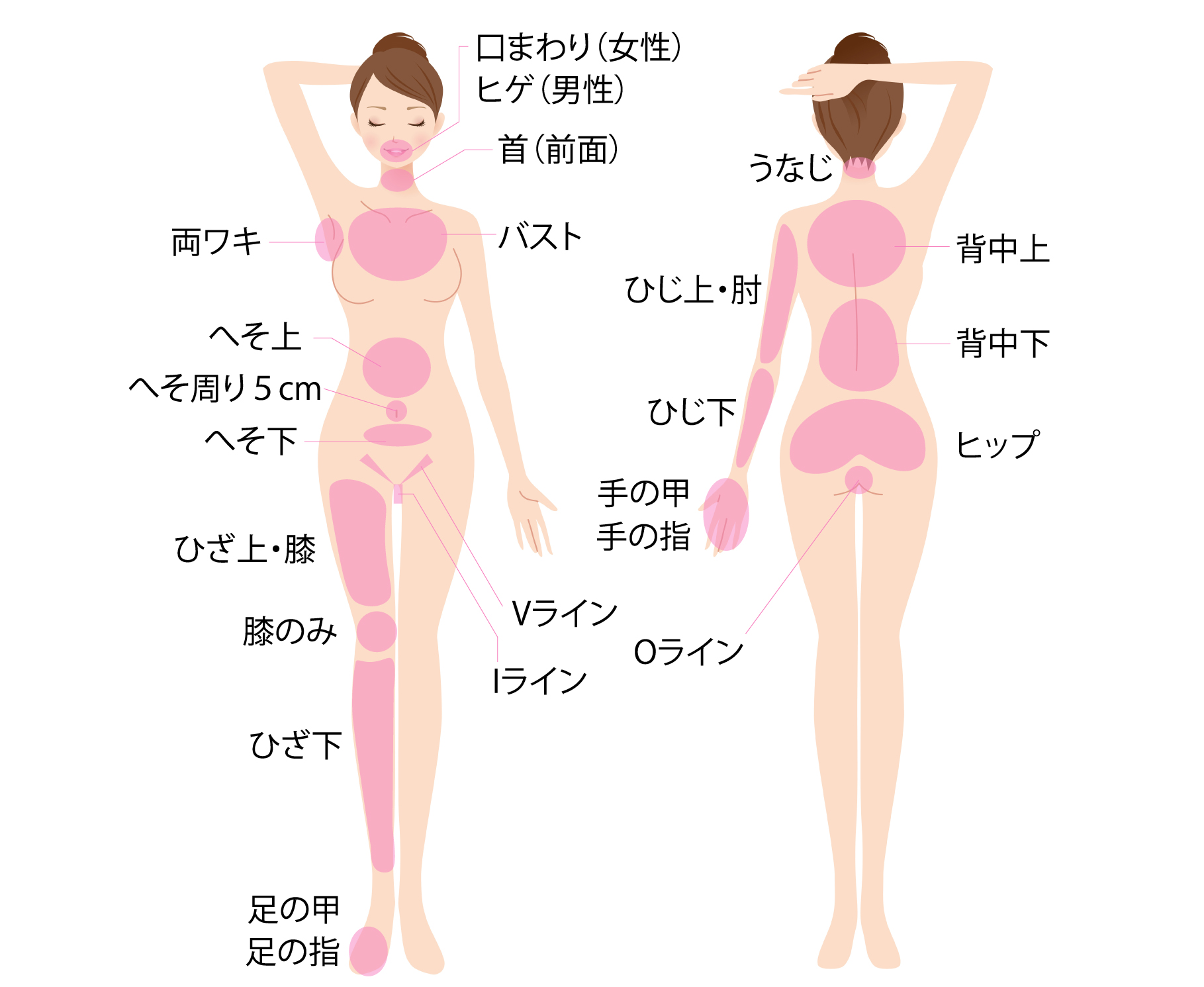 脱毛部位
