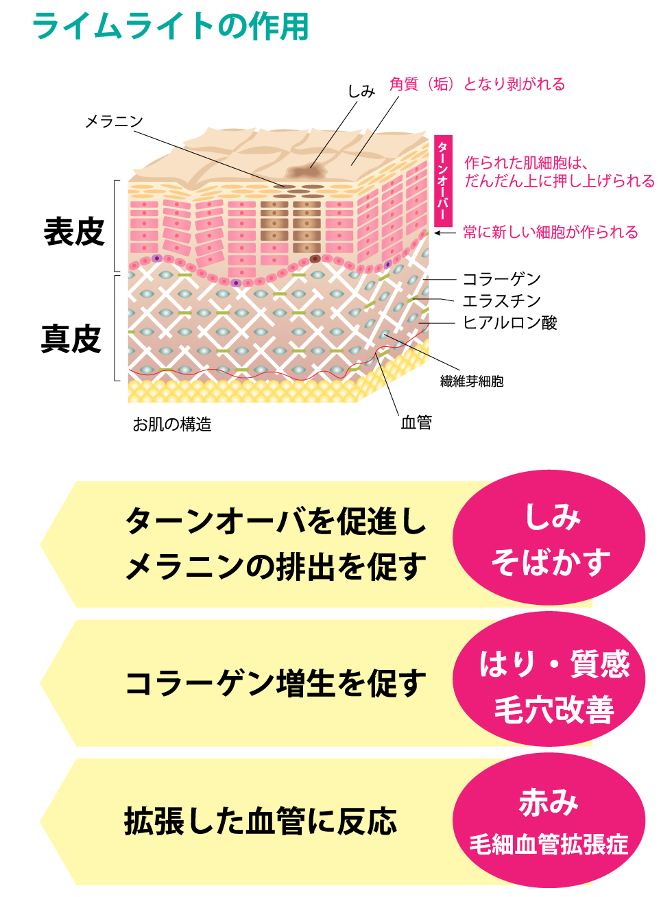 ライムライト