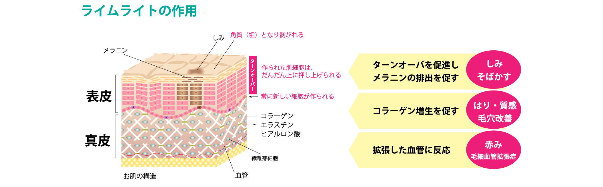 ライムライト