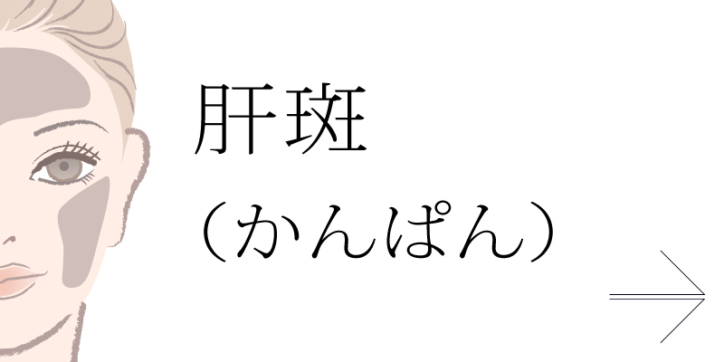 肝斑